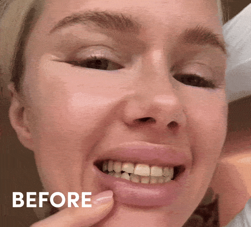 Your Dream Smile is Just