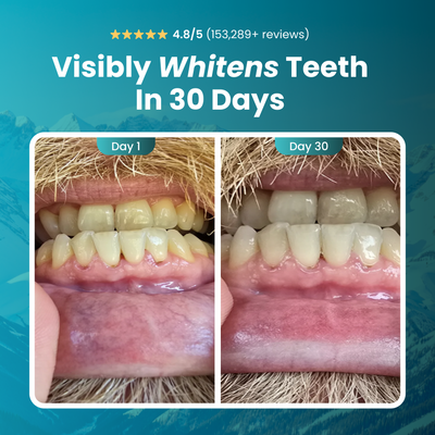 Magic Remineralizing Gum